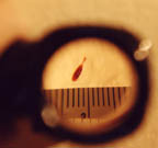 Small but significant blood drop